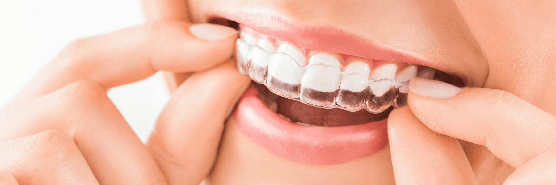 Orthodontics | Dentist