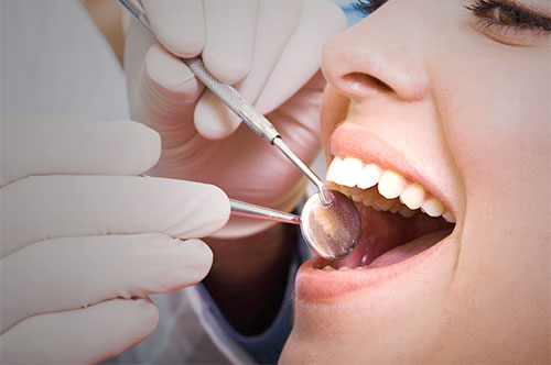 Start the Year Clean With a January Dental Reboot